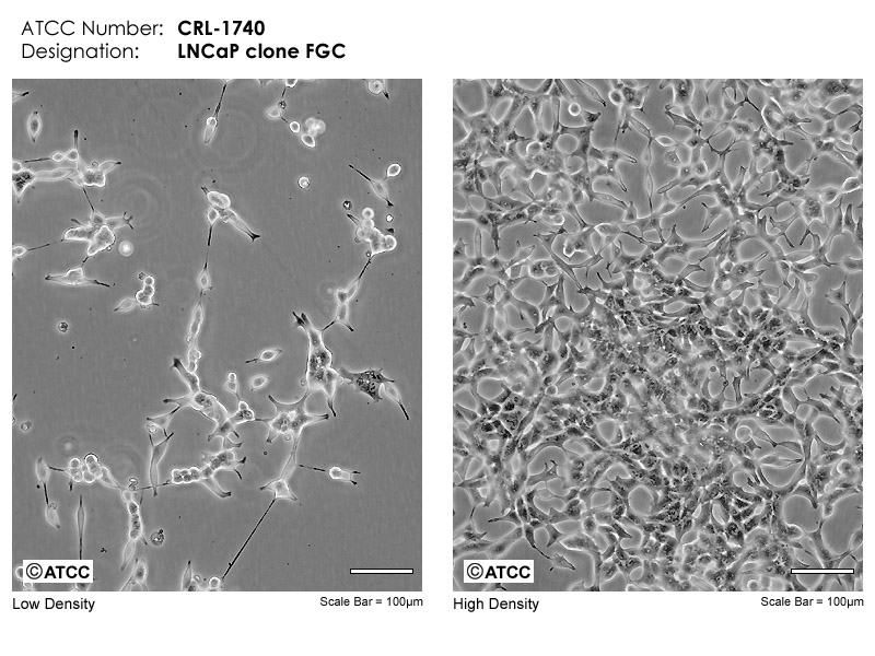 LNCaP clone FGC细胞图片
